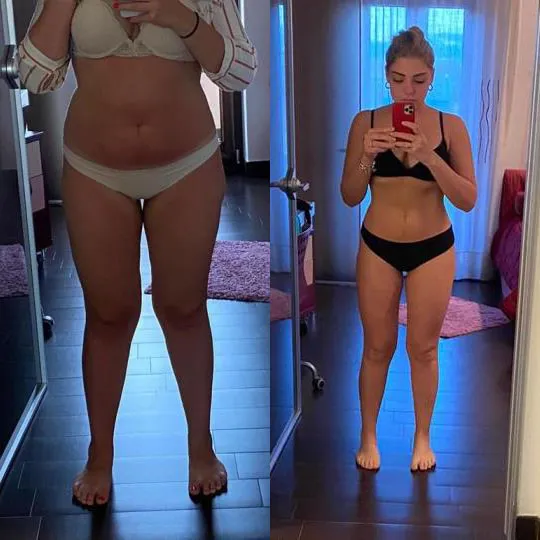 risultati-del-palloncino-gastrico-allurion-testimonianza-2 risultati del palloncino gastrico allurion per donna di 27 anni