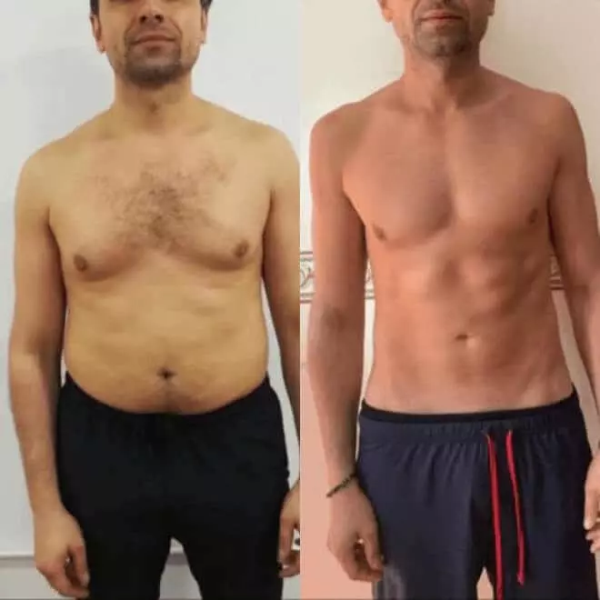 risultati-del-palloncino-gastrico-allurion-testimonianza-5 risultati del palloncino gastrico allurion per uomo di 41 anni