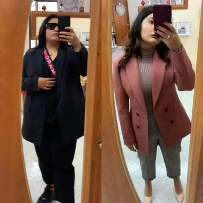 risultati-del-palloncino-gastrico-allurion-testimonianza-6 risultati del palloncino gastrico allurion per ragazza di 24 anni
